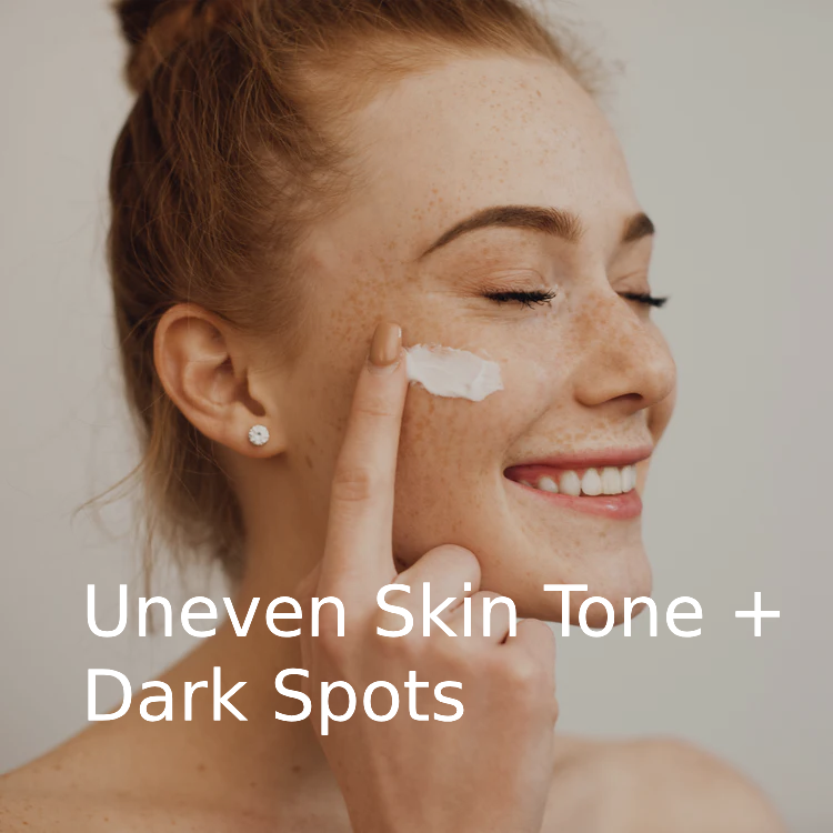 Uneven Skin Tone and Dark spots banner